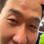 V stredu dostal jeho syn Heung-min počas osláv Tottenham's Cupu vojnovú jazvu.