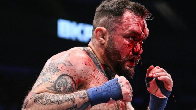 Mike Richman BKFC zdieľa zdesené obrazy zníženia krvi straty

