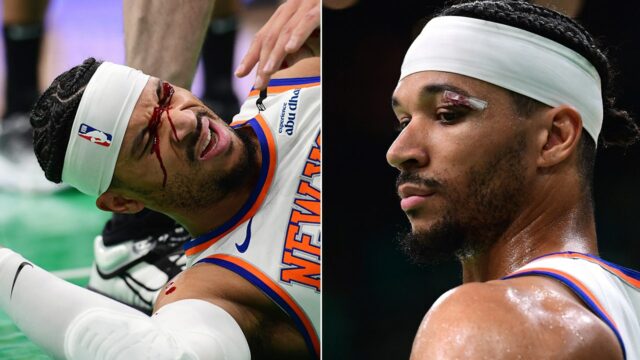 Play -off NBA: Knicks 'Josh Hart opúšťa hru krátko s krvavým okom

