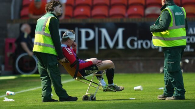 Mackenzie bol zasiahnutý predmetom po Aberdeenovej porážke proti Dundee