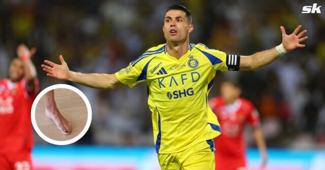Prečo Cristiano Ronaldo maľuje čierne nechty? Povrchový motív po Instagramovom obrázku vedľa svojich diskusií o synovi Spara online

