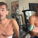Askren ukazuje fyziku transplantácie po pľúcni, sľub, že vybuduje