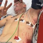 Legenda Aussie Superbikes Troy Bayliss začala publikovať fotografiu na Instagrame po zraneniach nemocnice po nehode na bicykli