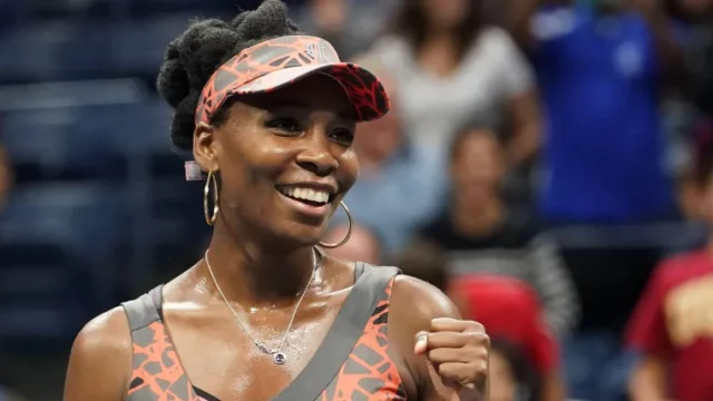 Venus Williams explains why she would consider cosmetic surgery image