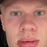 Erling Haaland požaduje stehy po celebrite „napísaných“ v fanatickom zranení tváre
