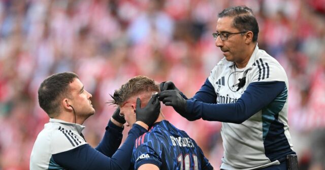 Informácie o zbierke: Viktor Gyokery 'Breaks Ticho Ticho, keď sa Arteta stretne s Guy City Problém 

