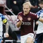 Milne's nárast z náhradného ľavého chrbta do pulzujúceho agresora sŕdc