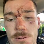Tom Starling to vie - jeho kariéra NRL sa zdala byť v limbu po bitke, ktorá sa týkala polície NSW v decembri 2020 (na obrázku, následky, ktoré sa neskôr konalo na súde)