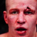 Mark Vologdin reaguje na dohodu UFC, poskytuje aktualizáciu zdravia a wellness