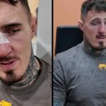 Tom Aspinall reaguje na UFC 321 žiadna súťaž, aktualizuje problém oka