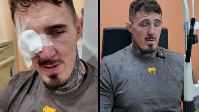 Tom Aspinall reaguje na UFC 321 žiadna súťaž, aktualizuje problém Tom Aspinall reaguje na UFC 321 žiadna súťaž, aktualizuje problém oka