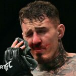 Tom Aspinall holds his hurt eye at UFC 321