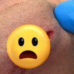 Ricky Simon trpí brutálnym porezaním brady na UFC Vegas 111