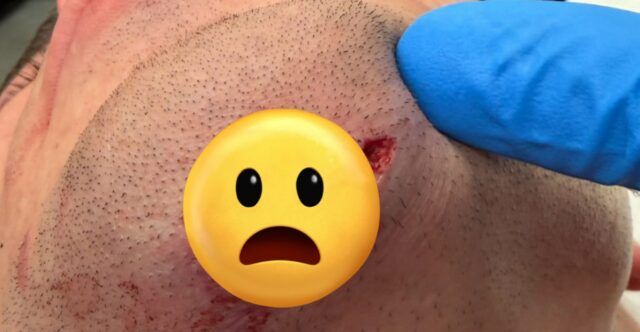 Ricky Simon trpí brutálnym porezaním brady na UFC Vegas 111 Ricky Simon trpí brutálnym porezaním brady na UFC Vegas 111