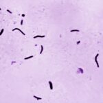 Tuberkulóza minulý rok zabila 1,23 milióna ľudí, tvrdí WHO | Správy Svetovej zdravotníckej organizácie