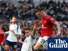 Zranený Sesko vynechá zápasy Slovinska, ale United dúfajú v rýchly návrat | Manchester United Zranený Sesko vynechá zápasy Slovinska, ale United dúfajú v rýchly návrat | Manchester United