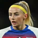 Anglická útočníčka Chloe Kelly odhalila svoje problémy s úzkosťou a alopéciou