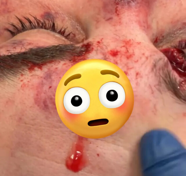 Hrubé! Dana White zdieľa video so zničenou tvárou Seana Sharafa Hrubé! Dana White zdieľa video so zničenou tvárou Seana Sharafa po UFC Vegas 112