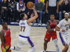 Hviezda Lakers Luka Doncic utrpela proti Clippers zranenie nohy Hviezda Lakers Luka Doncic utrpela proti Clippers zranenie nohy