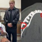 Jake Paul odhalil dvojitú zlomeninu čeľuste po prehre KO proti Anthonymu Joshuovi