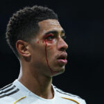 Skutočné zrútenie: 0:2 pre Celtu, 3 vylúčení, Jude krváca 😱 Barça odstúpila