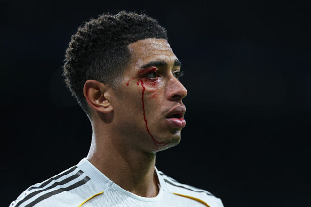 Skutočné zrútenie: 0:2 pre Celtu, 3 vylúčení, Jude krváca 😱 Barça odstúpila
