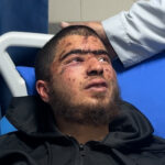 Video: Palestínsky tínedžer hovorí, že bol mučený pri únose osadníka