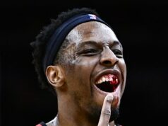 Hviezda NBA zdieľa krvavý obraz stratených zubov po lakti od Jaylena Browna Pán Okongwu