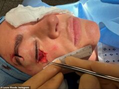 Laura Woods odhalila hrozné zranenie oka po hororovej nehode počas romantického úteku s hviezdnym snúbencom z Love Island Adamom Collardom Moderátorka TNT Sports Laura Woodshasová prezradila strašné zranenie oka, ktoré utrpela na romantickom úteku so svojou snúbenicou Adamom Collardinom v roku 2024