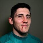 Anthony Belleau ukazuje svoju jazvu po šokujúcom zranení, kvôli ktorému musel ísť k zubárovi