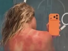 Tenisová hviezda žien odhalila bolestivé zranenie na Australian Open od slnka 22. januára 2025; Melbourne, Viktória, Austrália; Španiel Carlos Alcaraz gestikuluje počas zápasu so Srbom Novakom Djokovičom vo štvrťfinále dvojhry mužov na Australian Open 2025 v Melbourne Parku. Povinný kredit: Mike Frey-Imagn Images