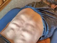 Americká olympijská hviezda Mikaela Shiffrin predvádza neuveriteľné balenie šiestich… na CHRBTE Lyžiarska superhviezda Mikaela Shiffrin, 30, nahrala klip, na ktorom leží tvárou nadol na lehátku s vysoko vyhrnutým vrchom, aby odhalila jej obnažený svalnatý chrbát.