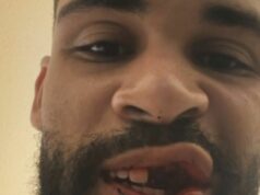 Anglický futbalista Ruben Loftus-Cheek odhalil hrozné zranenia po strašidelnom strete|Futbal|Športová aktivita Anglický futbalista Ruben Loftus-Cheek odhalil hrozné zranenia po strašidelnom strete|Futbal|Športová aktivita