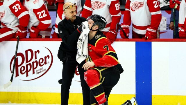 Brady Tkachuk senátorov zakrvavený, dostal sa do hry v zápase Brady Tkachuk senátorov zakrvavený, dostal sa do hry v zápase v NHL