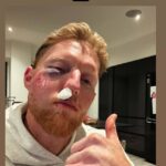 Ben Stokes zanechal fanúšikov šokovaných a znepokojených, keď na sociálnych sieťach zdieľal príšernú fotografiu