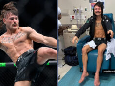 Diego Lopes si pri prehre v UFC 325 „zlomil obe nohy“, ale nemá „žiadne výhovorky“ Download app from appStore