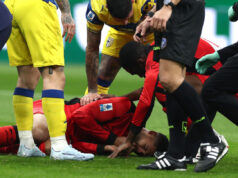 Obrázky: Loftus-Cheek ukazuje chýbajúce zuby po škaredom strete s Corvi Obrázky: Loftus-Cheek ukazuje chýbajúce zuby po škaredom strete s Corvi