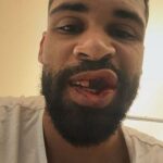 Ruben Loftus-Cheek prelomil mlčanie po nedeľnom hroznom zranení