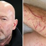 Alan Shearer zdieľa škaredé zranenia z nehody na bicykli, keď učenec BBC narazil do výmolu | Futbal | Šport