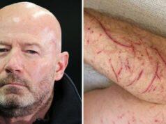 Alan Shearer zdieľa škaredé zranenia z nehody na bicykli, keď učenec BBC narazil do výmolu | Futbal | Šport Alan Shearer zdieľa škaredé zranenia z nehody na bicykli, keď učenec BBC narazil do výmolu | Futbal | Šport