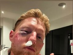 Ben Stokes utrpel neúspech na ceste, aby sa vrátil z hororového zranenia tváre, pretože chirurg prináša zlé správy pred sezónou County Championship Stokes sa pokúsil vidieť vtipnú stránku, keď minulý mesiac uverejnil tento obrázok na Instagrame