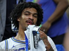 Hviezda March Madness prišla o ZUB po tom, čo si ublížil lakťom do tváre… skôr, ako ho jeho spoluhráč nájde na ihrisku Hviezda UCLA Skyy Clark utrpela vážne zranenie, pri ktorom prišiel o predný zub