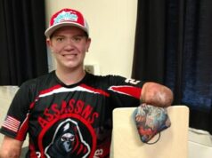 Profesionálny hráč bez rúk a nôh čelí obvineniam z vraždy… ale je to len najnovší zvrat v skutočne šokujúcom životnom príbehu Profesionálny hráč cornhole a štvornásobne amputovaný Dayton James Webber bol v nedeľu zatknutý pre obvinenie z vraždy.