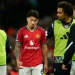 Lisandro Martinez bol vylúčený za ťahanie Dominica Calverta-Lewina za vlasy (Reuters)