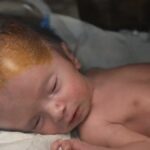 Neviditeľné obete Gazy: A vznikajú pri mŕtvo narodených a vrodených chybách | Slučka