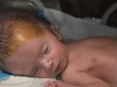 Neviditeľné obete Gazy: A vznikajú pri mŕtvo narodených a vrodených chybách | Slučka Neviditeľné obete Gazy: A vznikajú pri mŕtvo narodených a vrodených chybách | Slučka