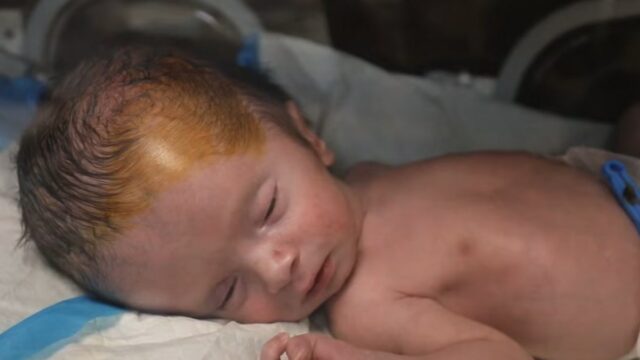 Neviditeľné obete Gazy: A vznikajú pri mŕtvo narodených a vrodených chybách | Slučka
