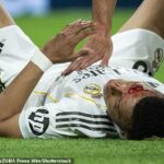 Kylian Mbappe zostal zakrvavený po tom, čo dole udrel lakťom do tváre Gironu