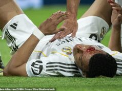 Zápach Realu Madrid, keď Kylian Mbappe zostal zakrvavený po tom, ako bol zasiahnutý počas hroznej remízy s Gironou – ale neudeľuje sa ŽIADNA penalizácia, pretože boje Alvara Arbeloa pokračujú Kylian Mbappe zostal zakrvavený po tom, čo dole udrel lakťom do tváre Gironu