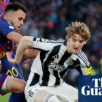 Anthony Gordon absolvuje lekárske vyšetrenie v Barcelone pred prestupom za 69,3 milióna libier z Newcastlu | Newcastle UnitedEdit